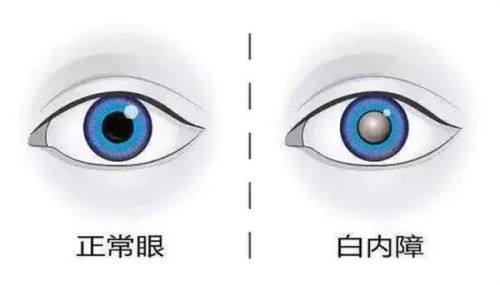 高平复明眼科医院地址电话营业时间