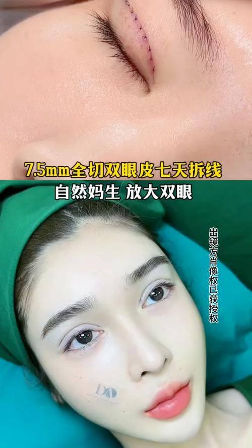 韩国首尔第一整形外科详细的预约挂号方式及流程