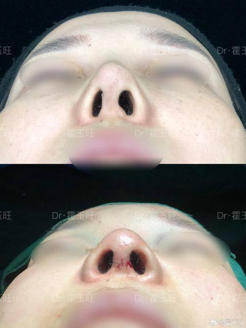 田永华医生擅长项目