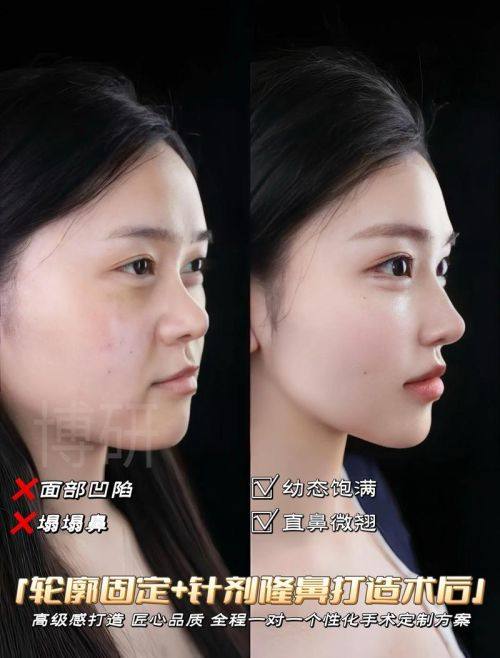 韩国首尔第一整形外科收费价格表/收费标准