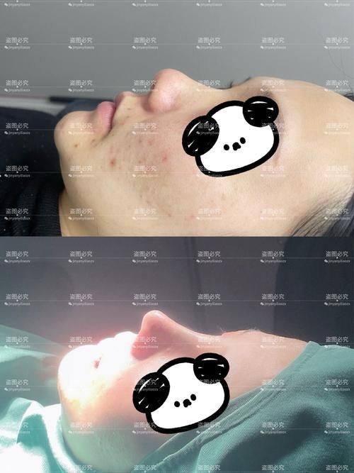 田永华医生口碑评价及真人实例