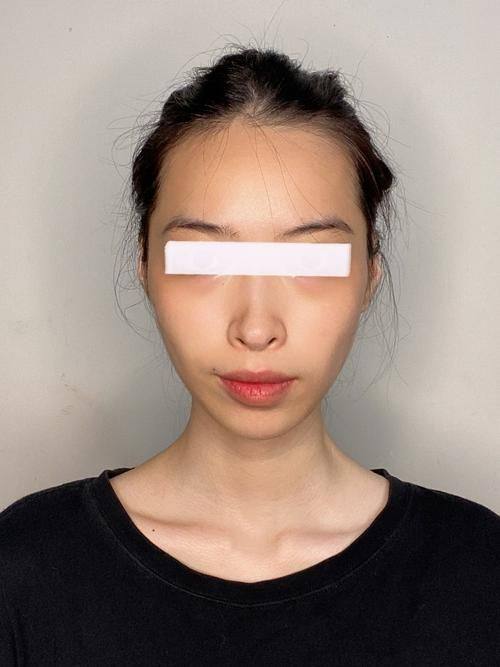 韩国首尔第一整形外科特色项目及技术优势