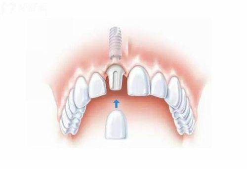 陶胤彤医生擅长项目