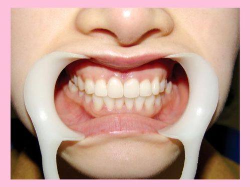 陶胤彤医生技术优势