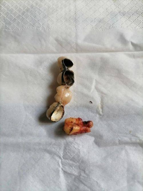 陶胤彤医生擅长项目