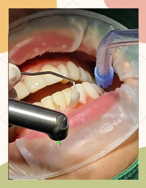 广东东莞石碣固芽口腔门诊部真人口碑评价怎么样？