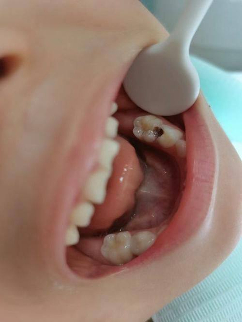 杭州深蓝口腔（世茂缤谷门诊）是正规医院吗？