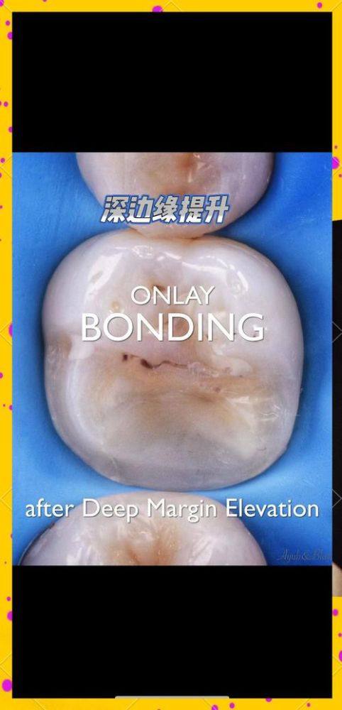 陶胤彤医生擅长项目