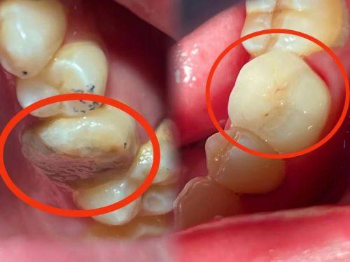 陶胤彤医生坐诊医院