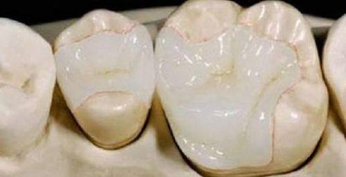 陶胤彤医生技术优势