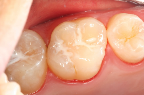 陶胤彤医生技术优势
