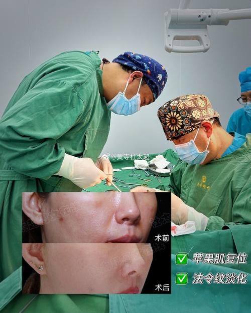 尹泰镐医生技术优势