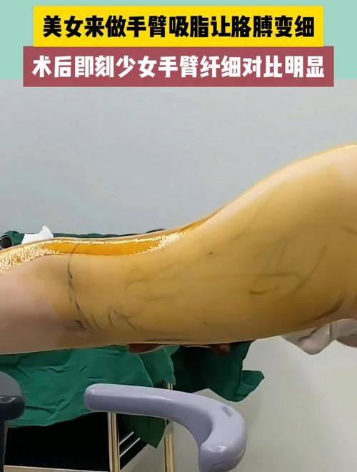 合肥洛菲医疗美容整形门诊部特色项目及技术优势