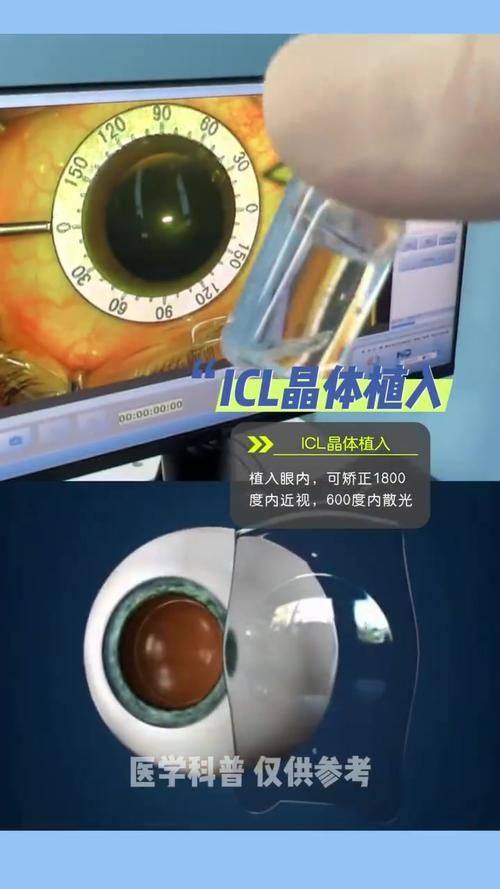 李兰英医生价格表