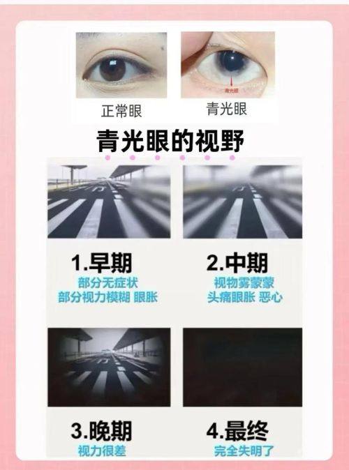 李兰英医生口碑评价及真人实例