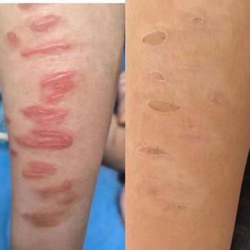 合肥洛菲医疗美容整形门诊部真人口碑评价怎么样?