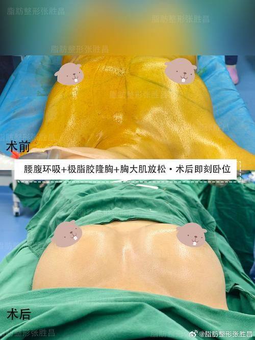 莆田慕一医疗美容诊所详细的预约挂号方式及流程