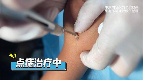 杭州颜术医疗美容诊所真人口碑评价怎么样?