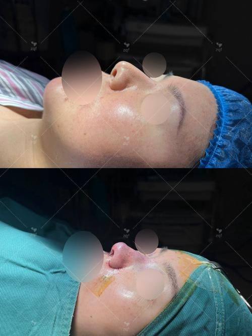 驻马店华美医疗美容医院收费价格表/收费标准