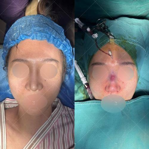 莆田慕一医疗美容诊所真人口碑评价怎么样？