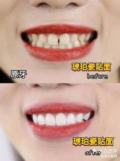 商丘景丰口腔门诊部地址电话营业时间