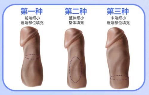 南京京科医院真人口碑评价怎么样？