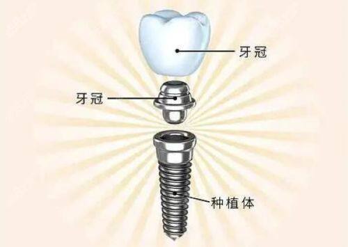 口碑评价及真人实例