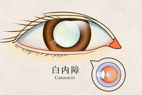 临沂润视眼科医院是正规医院吗？