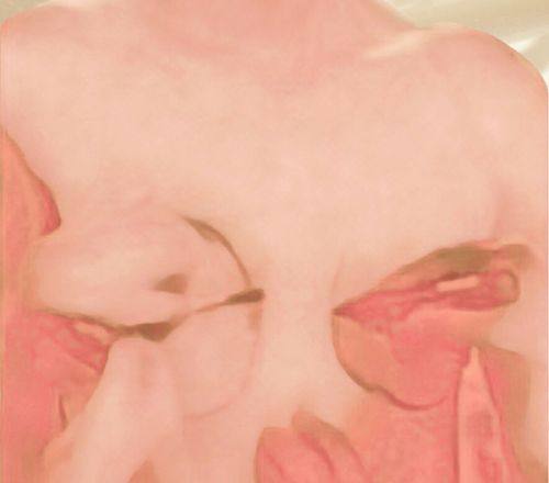 南京轻颜医疗美容诊所真人口碑评价怎么样？