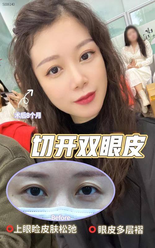 株洲华美整形美容医院真人口碑评价怎么样？