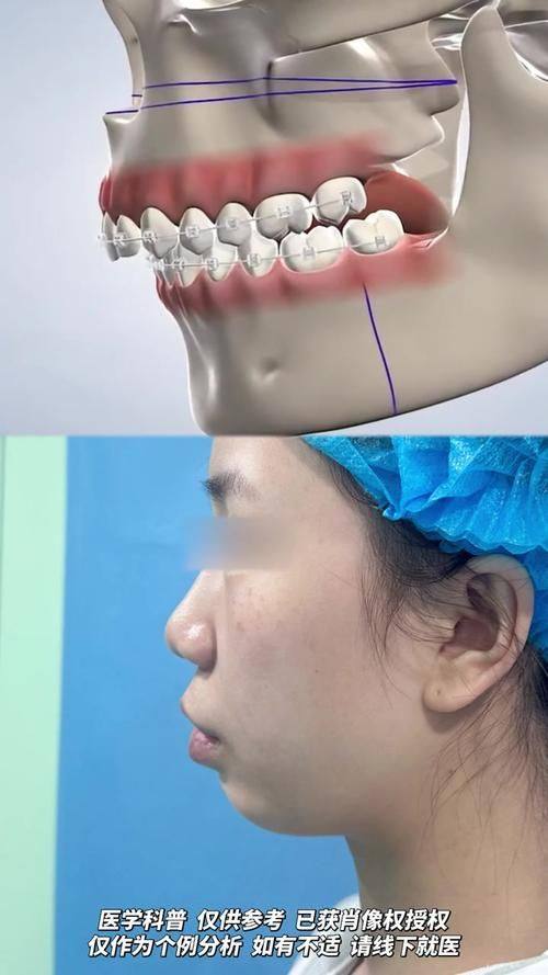 尹泰镐医生擅长项目