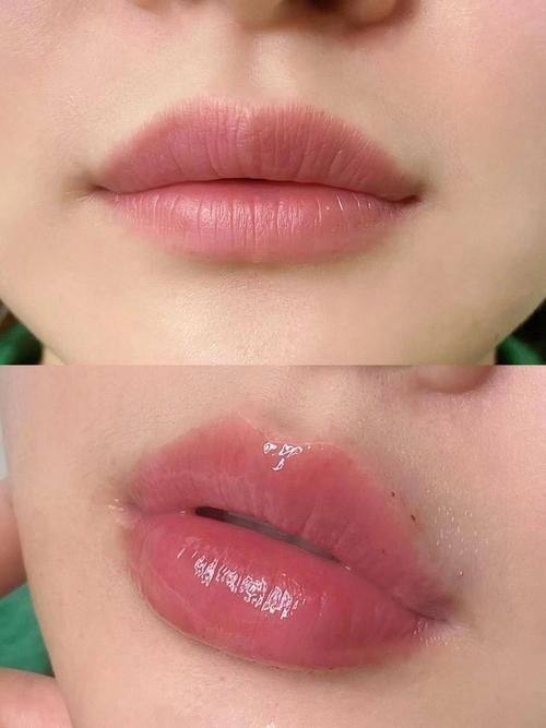 常熟圣莎拉医疗美容门诊真人口碑评价怎么样？