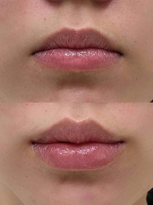 常熟圣莎拉医疗美容门诊详细的预约挂号方式及流程