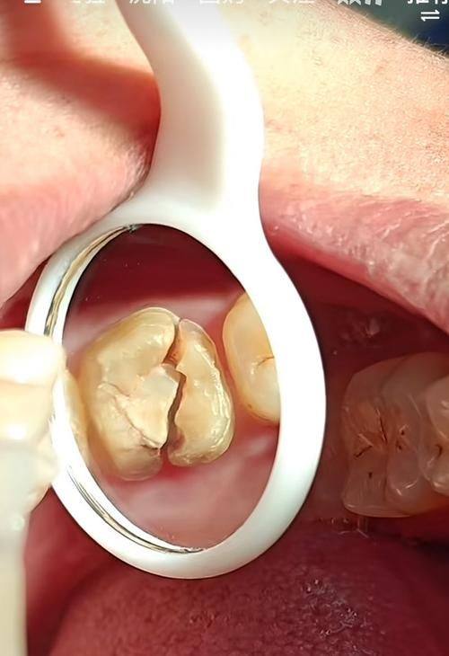 陕西宝鸡爱雅口腔诊所特色项目及技术优势
