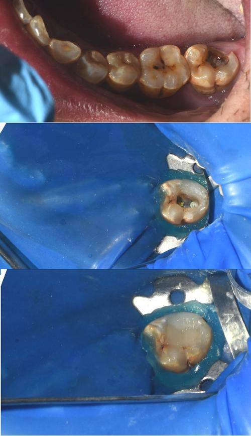 口碑评价及真人实例