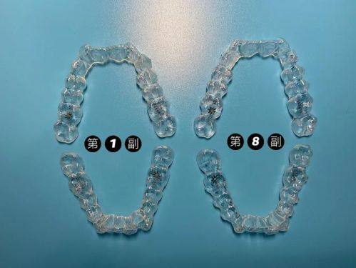 陕西宝鸡爱雅口腔诊所收费价格表/收费标准