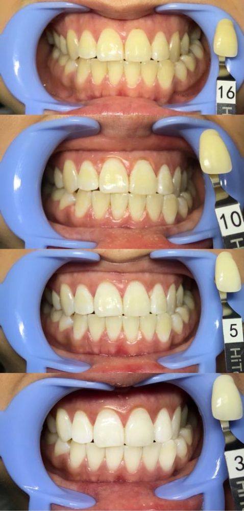 内蒙古赤峰陈宁九七三口腔地址电话营业时间