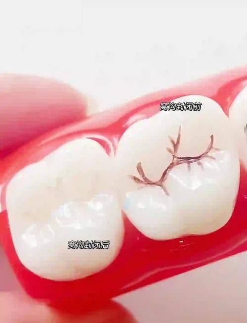 内蒙古赤峰陈宁九七三口腔是正规医院吗？