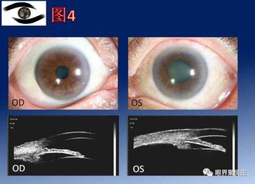 巴林左旗中医蒙医医院特色项目及技术优势