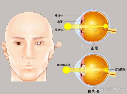 临沂润视眼科医院特色项目及技术优势