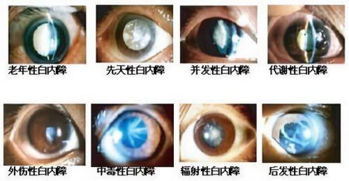 山西阳泉爱维视医疗收费价格表/收费标准