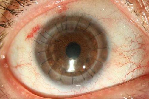 临沂润视眼科医院医生团队实力强大及骨干医生简介