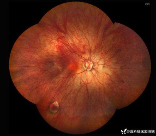 巴林左旗中医蒙医医院医生团队实力强大及骨干医生简介