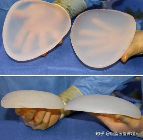 昆明盛路医疗美容诊所真人口碑评价怎么样？