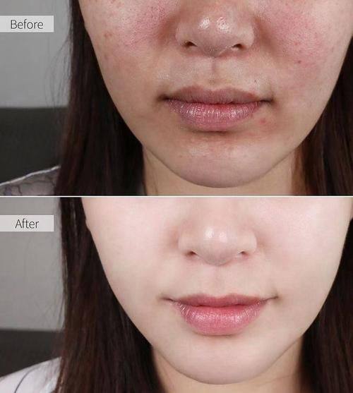 深圳美加美医疗美容诊所收费价格表/收费标准