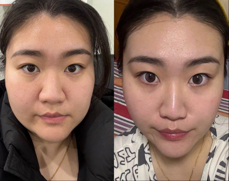 株洲华美整形美容医院收费价格表/收费标准