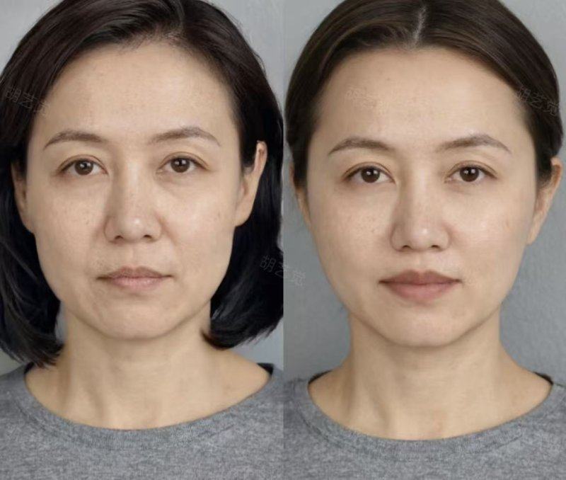 深圳美加美医疗美容诊所详细的预约挂号方式及流程