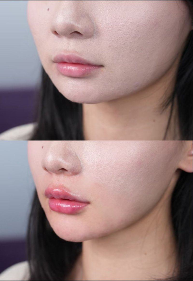 南京轻颜医疗美容诊所详细的预约挂号方式及流程