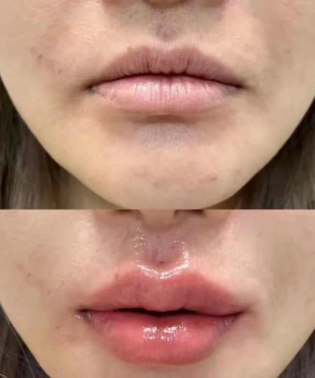 南京京科医院详细的预约挂号方式及流程