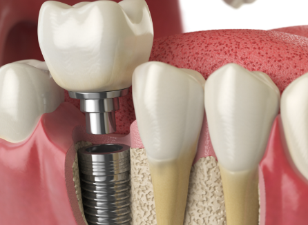 康健医生价格表